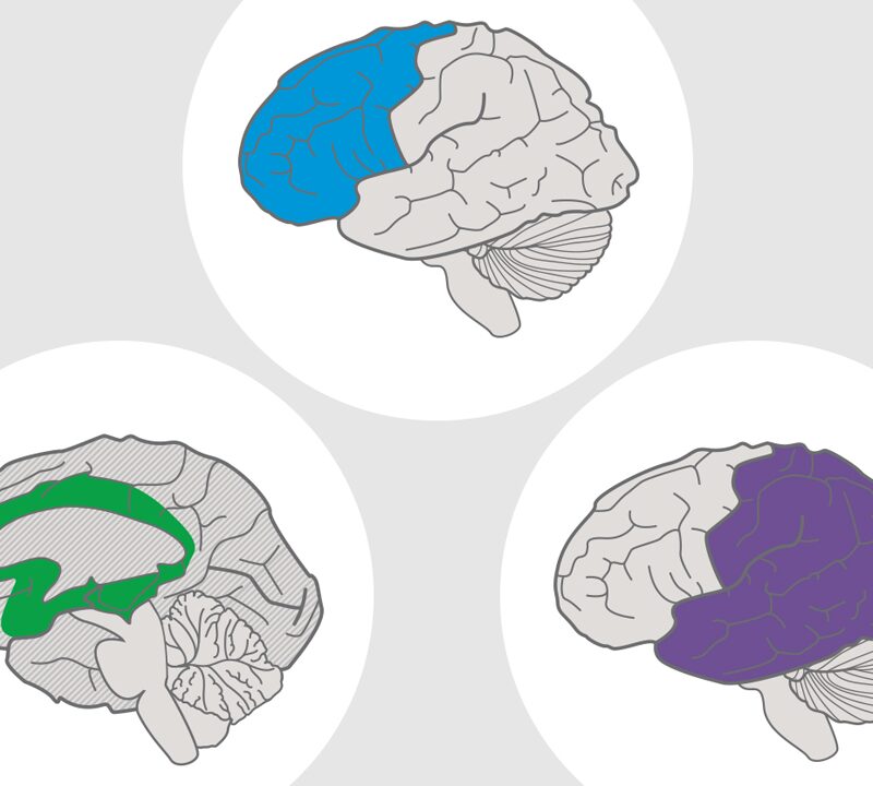 Illustration of three UDL brain networks: affective, recognition, strategic